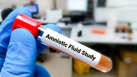 gloved hand holding a test tube labeled "Amniotic Fluid Sample" in a lab setting