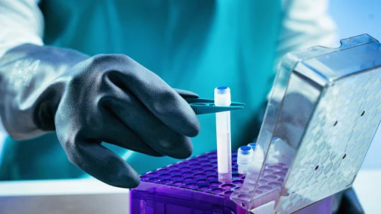 A gloved hand using tweezers to handle a vial in a purple lab container, representing sample preparation in regenerative medicine
