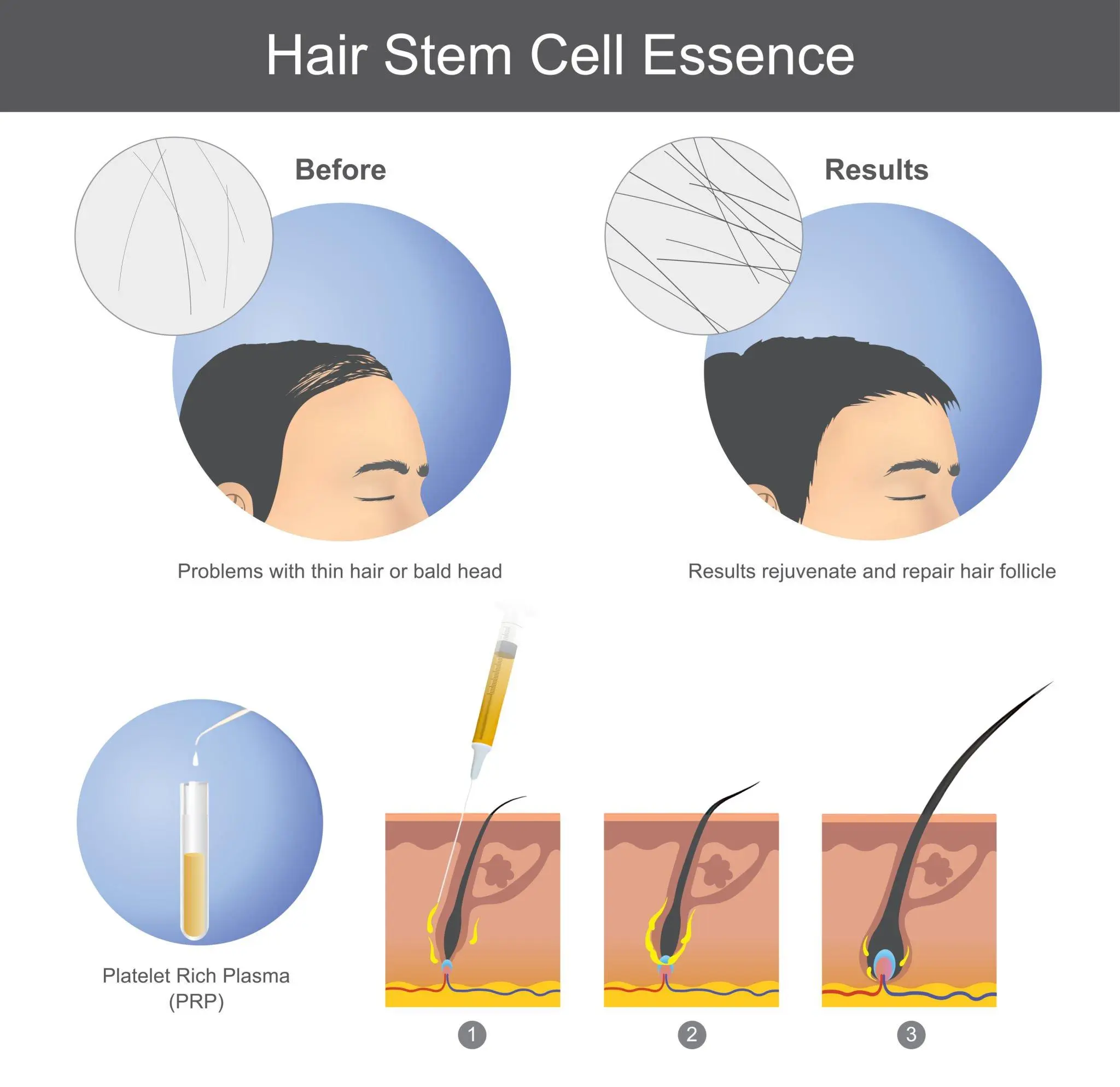 Diagram depicting stem cell-derived exosomes facilitating cell-to-cell communication by transporting proteins, cytokines, and growth factors for therapeutic activities and inflammation reduction.
