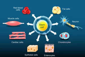 A table summarizing research findings on stem cell therapy for Multiple Sclerosis, including treatment protocols, patient outcomes, and EDSS score improvements.