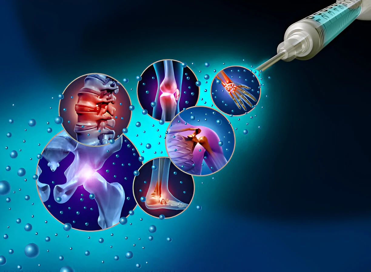 stem-cell-injection-diagram-joint-back-pain-liberty-lake