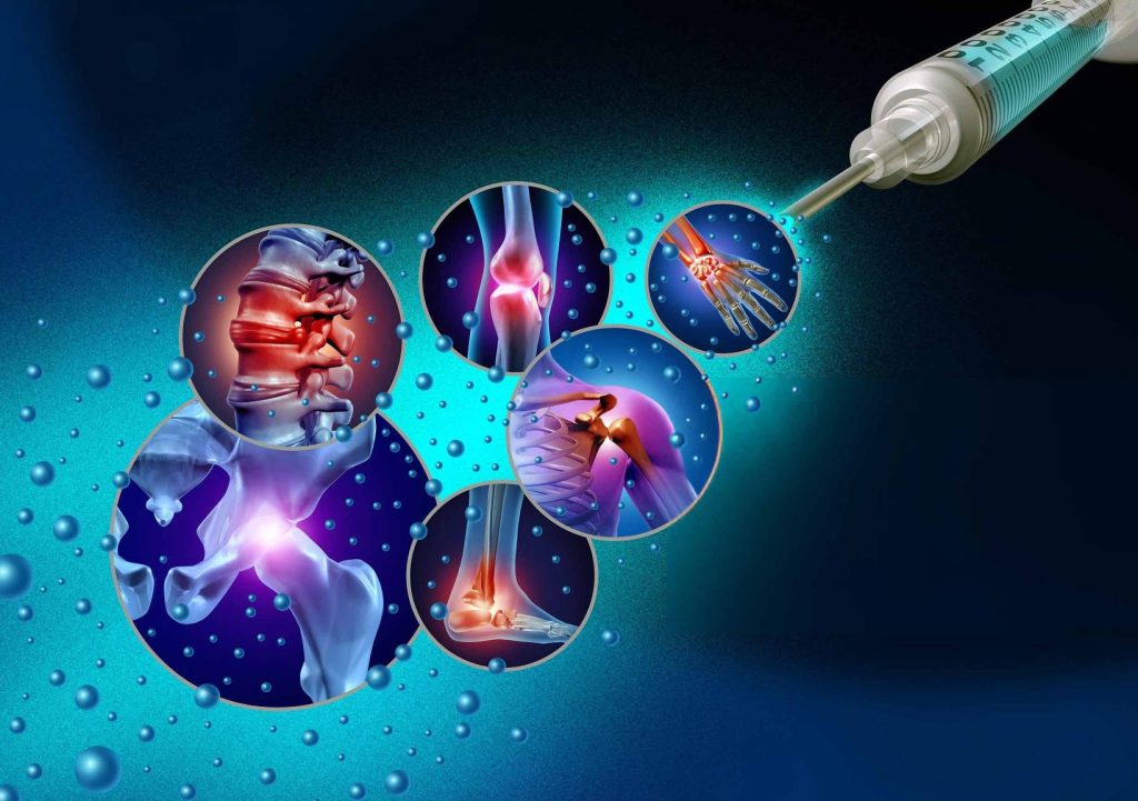 An illustration of how non-surgical stem cell treatments target joint pain in the knee, back, shoulder, and hip for patients in Westwood, MA.