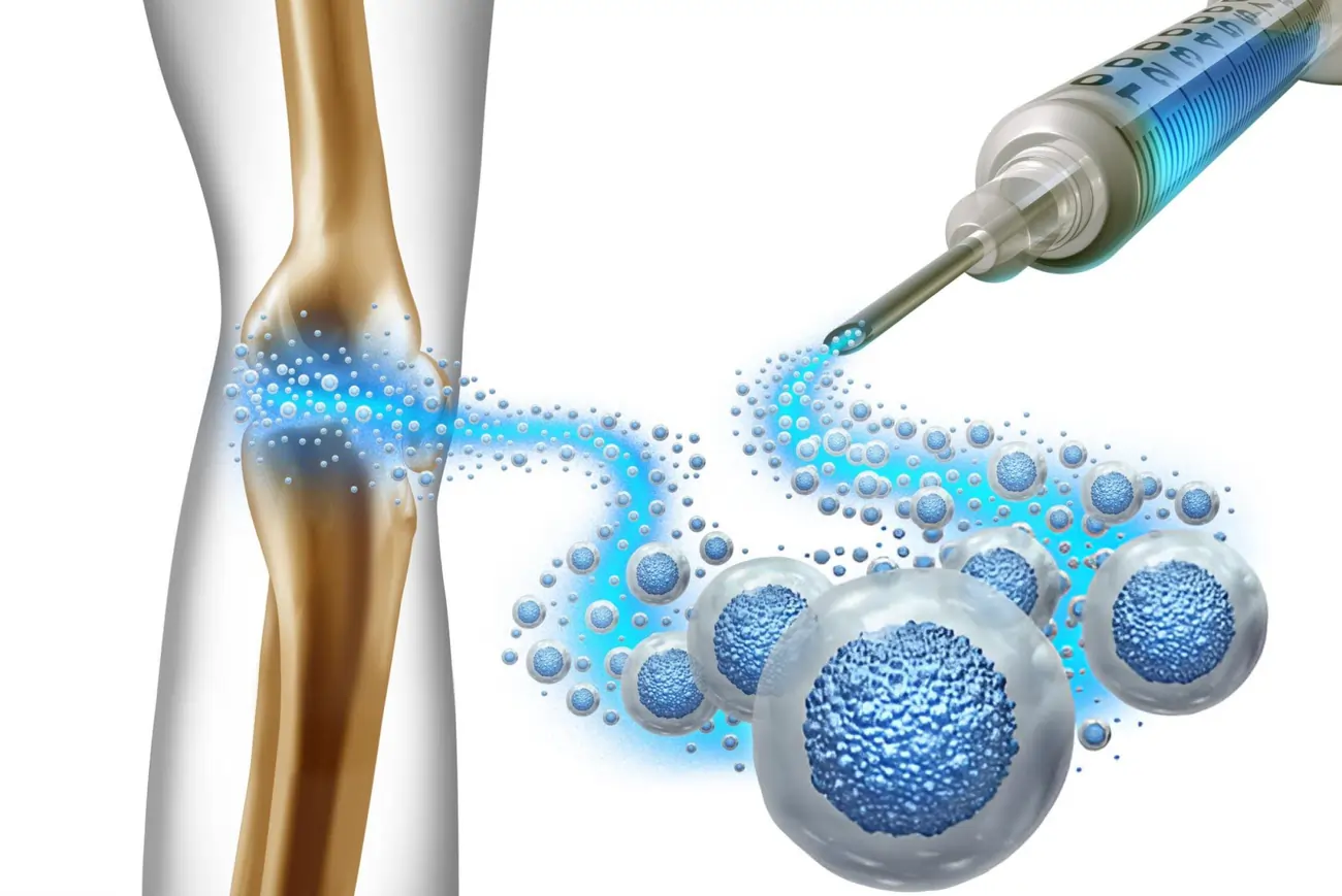 An illustration of a syringe injecting stem cells into a knee joint for regenerative medicine and pain management.